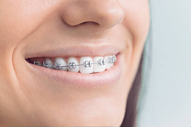 Best Traditional Braces  in Ridley Rk, PA